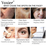 2pcs Yoxier Dark Spot Removal Cream Freckle Cream Dark Spots Corrector Fade Pregnancy Spot Melanin Pigmentation Whiten Skin Care