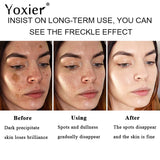 2pcs Yoxier Dark Spot Removal Cream Freckle Cream Dark Spots Corrector Fade Pregnancy Spot Melanin Pigmentation Whiten Skin Care